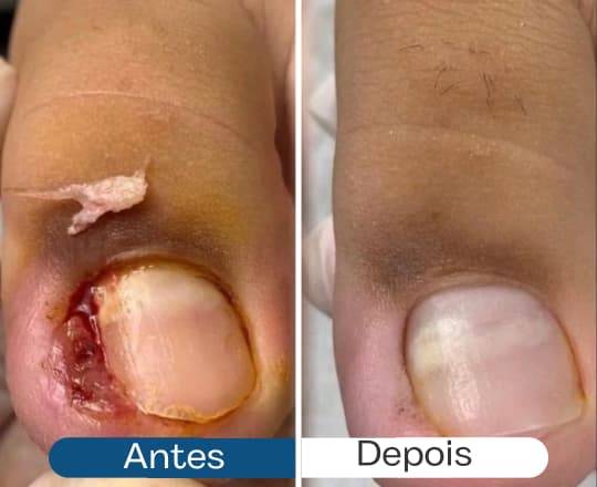 Antes e depois 3