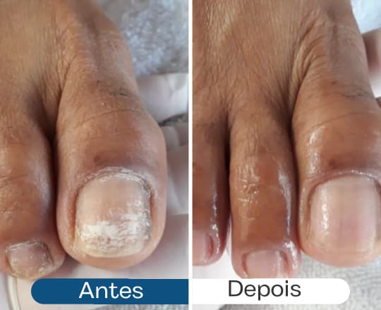 Antes e depois 4