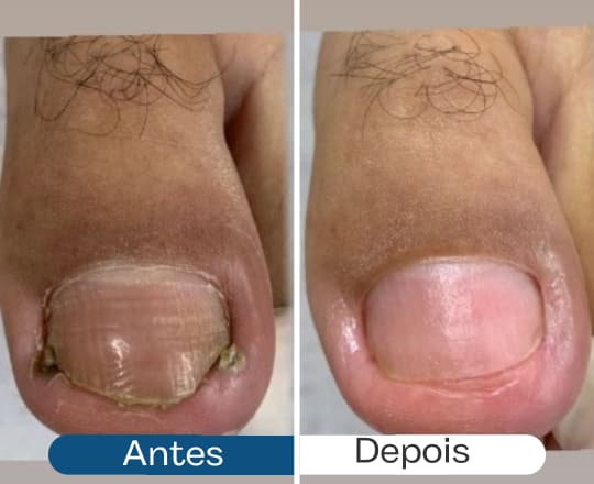 Antes e depois 6